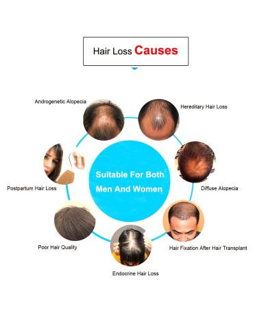 Q-BAIHE Laser Hair Growth Helmet Silver 160 LLLT Anti-Alopecia Hair Growth Cap - Buy Online on GoSupps.com