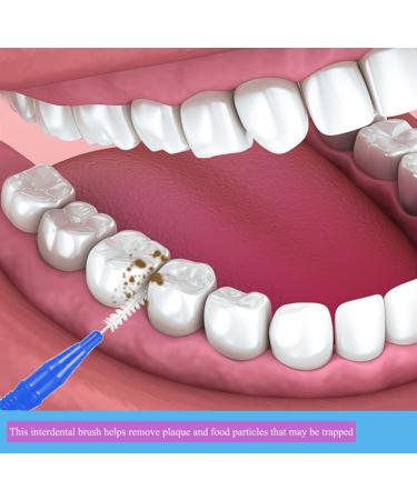 Interdental Gum Brushes - 360 Angled Soft Bristles | Tight Tooth Cleaning Tools - Floss Cleaner 2 Sizes for Effective Oral Care - Buy Online on GoSupps.com