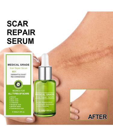 Yanolam Goopgen Advanced Scar Repair Serum - Medical Grade Gentle Scar Removal Spray - 2023 New Formula - For All Types - 1 Pcs - Buy Online on GoSupps.com
