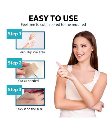 Silicone Scar Tape (1.6 x 120 Roll) - Medical Silicone Sheets for Scar Removal - Keloids, Tummy Tuck, C-Section, Acne, Burn - 7-8 Month Supply - Buy Online on GoSupps.com