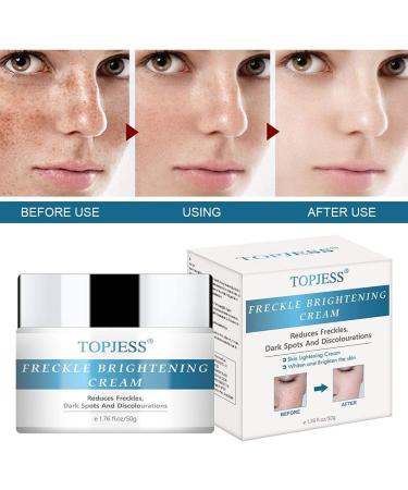 Hope's Relief Skin Barrier Lotion - Soothing & Protective Skincare Solution - Buy Online on GoSupps.com