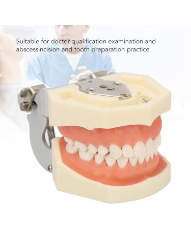 Upper Jaw Cyst Teeth Model - Tooth Preparation & Soft Gums for Pupillary Abscess Incisions | International Shipping - Buy Online on GoSupps.com