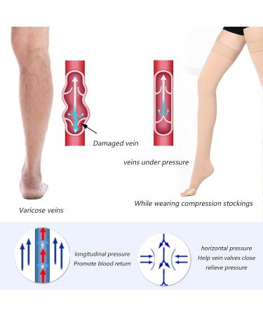 MDCG Compression Stockings for Men & Women | Thigh Support Tights for Varicose Veins & Edema - Class 1 - Buy Online on GoSupps.com