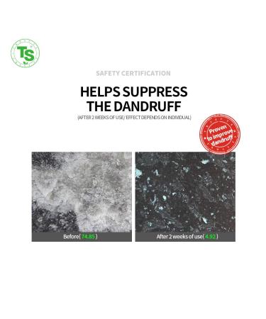 Plus TS Shampoo with Biotin - 16.9 Fl Oz | Anti-Hair Loss Therapy Shampoo | Korea Hair Care Solution for Damaged Hair in Men & Women - Buy Online on GoSupps.com