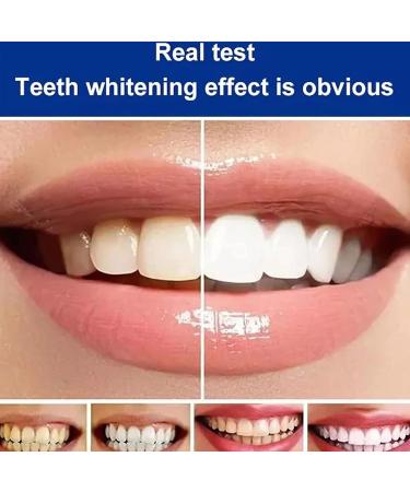 Yayashi SP-4 Toothpaste 120g | Twice Probiotic Whitening & Stain-Removing Toothpaste | Enhance Your Smile with Yiliku Zahnaufheller - Buy Online on GoSupps.com
