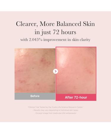 medicube TXA Glow & Care Duo: TXA+Niacinamide 15% Glow Facial Serum and Tranexamic+Niacinamide Capsule Cream - Buy Online on GoSupps.com