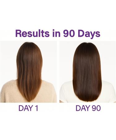 Vita4Life! Biotin 2000mcg + MSM Hair Growth Vitamins for Women & Men | Hair Skin & Nail Support Supplement with Vitamin A E Zinc | Fast Absorbing Capsules 60 Count 30-Day Supply - Buy Online on GoSupps.com