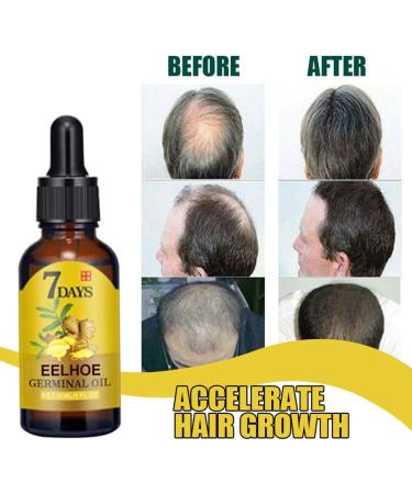 Enkomy Hair Growth Serum | 40ml Anti-Hair Loss Ginger Oil - Boost Hair Growth & Nourishment - Buy Online on GoSupps.com