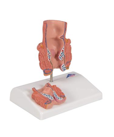 3B Scientific K27 Hemorrhoid Model with Smart Anatomy | Educational Tool - Buy Online on GoSupps.com