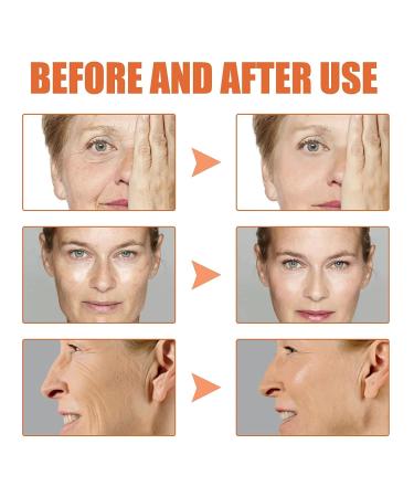 3pcs Botox Stock Solution Facial Serum - 2023 Newest Anti-Wrinkle & Anti-Aging Treatment endorsed by Jennifer Aniston - Buy Online on GoSupps.com