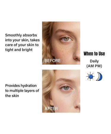 Facial Brightening Niacinamide Serum Reduces Dullness Evens Skin Tone Powerful Moisturizer Illuminating Serum Moisturizing Dryness Acne Skin Facial Essence Infused Rice Ferment vitamin B3 - Buy Online on GoSupps.com