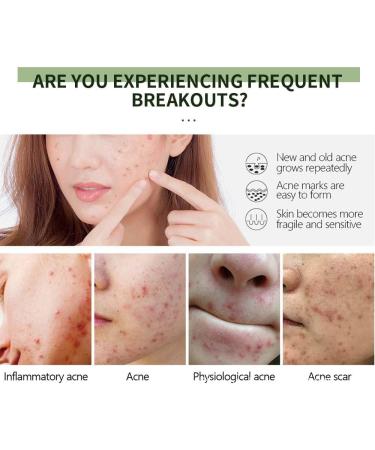 Anti-Acne Face Cream Anti-Acne Cream For Acne Treatment And Spot Treatment Skin Treatment Gel Cream For Face Blemishes & Blackheads Acne Treatment Cream Anti Acne Spot  - Buy Online on GoSupps.com