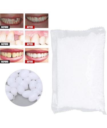 Temporary Tooth Repair Set - Formable Thermo-Fitting Pearls for Missing & Broken Teeth | Perfect for Halloween & Quick Repairs - Buy Online on GoSupps.com