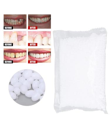 Temporary Tooth Repair Set - 100g | Fix Broken Teeth & Secure Prosthesis | Fast & Easy Dental Solution - Buy Online on GoSupps.com