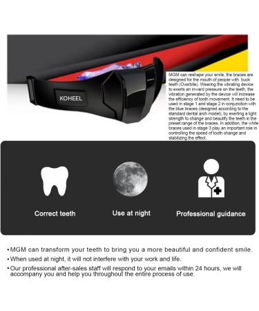 KOHEEL MGM Straightener for Adults for a Confident Smile (1 Pack) - Buy Online on GoSupps.com