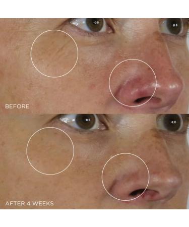 Tatcha Silk Serum 30ml | Wrinkle-Smoothing Retinol Alternative - Buy Online on GoSupps.com