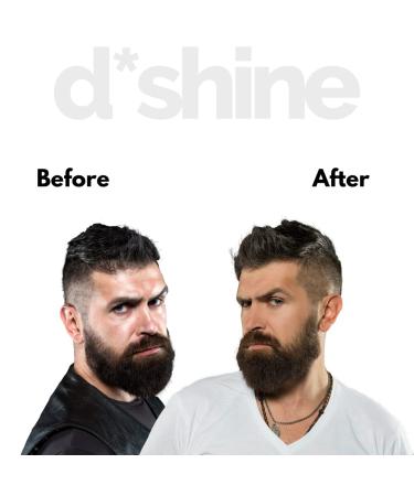 Men's Mattifying Moisturizer with Oil Control - Matte Finish Anti-Shine Lotion - Oil-Free & Non-Greasy Formula - 8 HR Mattifying - Quick Absorb Facial Moisturizer - Buy Online on GoSupps.com