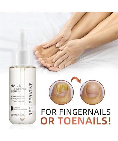 7 Days Nail Growth and Strengthening Serum Natural Nail Growth And Strength Serum Nail Repair Solution for Damaged and Discolored Nails Promotes Rapid Growth & Avoids Flaking (1pcs) - Buy Online on GoSupps.com