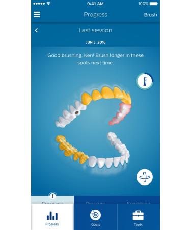 Philips Sonicare DiamondClean Smart 9300 Electric Toothbrush HX9903/11 - Black - Buy Online on GoSupps.com