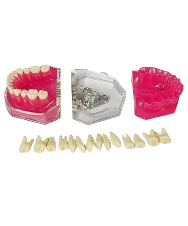 Dental Tooth Extraction Model Full Mouth Detachable 28pcs Tooth Simulation Facial Skin Model For Dentist Teaching Study (Teeth Model) - Buy Online on GoSupps.com
