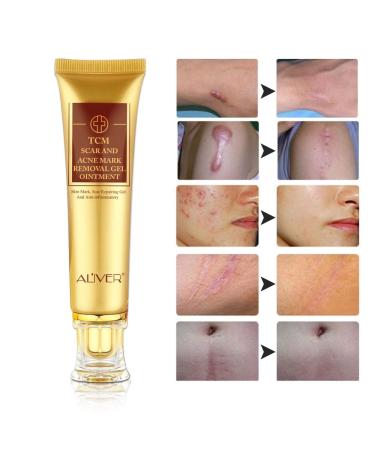 3 Pack TCM Scar Removal Cream - Scar Reducing Treatment for Stretch Marks, Acne Scars, Surgical Scars - 1.1 Ounce (Pack of 3) - Buy Online on GoSupps.com