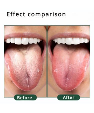 Stainless Steel Tongue Scraper - Effective Bad Breath Fighter & Oral Care Essential for Adults | Travel Friendly Tongue Cleaner (Green - Buy Online on GoSupps.com