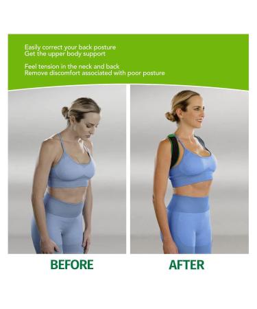 YUYTE Back Posture Corrector Brace | Hunchback Prevention & Pain Relief | Adjustable 8-Shaped Straps for Better Posture - Buy Online on GoSupps.com