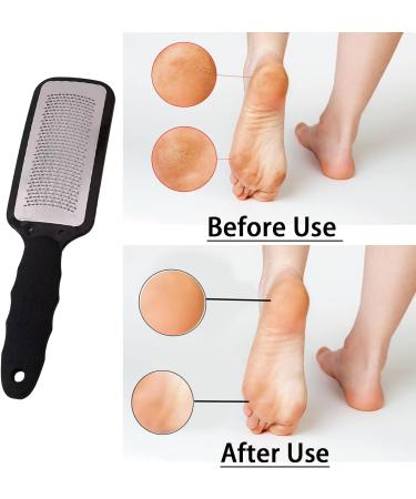 Stainless Steel Foot Callus Remover - Professional Pedicure Tool for Hard, Tough Skin - Home & Salon Use (Black) - Buy Online on GoSupps.com