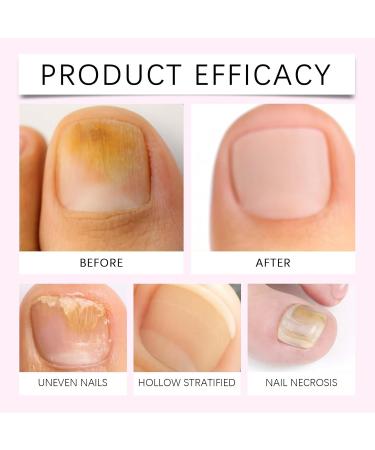 Stylo repousse-cuticules l'huile soin des ongles secs et ab m s hydrate fait briller r pare et nourrit les ongles. Stylo portable pour nettoyer les cuticules et les ongles fortifie. (12PCS) - Buy Online on GoSupps.com