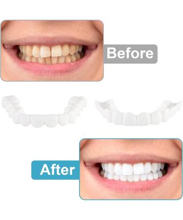 2 PCS Fake Teeth Dentures for Men and Women | Dental Veneers for Temporary Restoration | Natural & Comfortable | Protect Teeth & Regain Confidence | Natural Shade-n3 - Buy Online on GoSupps.com