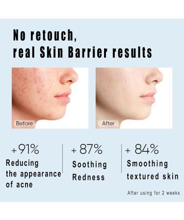 Barrier Repair Cream | Anti-Aging Moisturizer with Hyaluronic Acid & 5x Ceramides | Oil-Free Hydrating Gel for Redness & Acne Relief - Buy Online on GoSupps.com