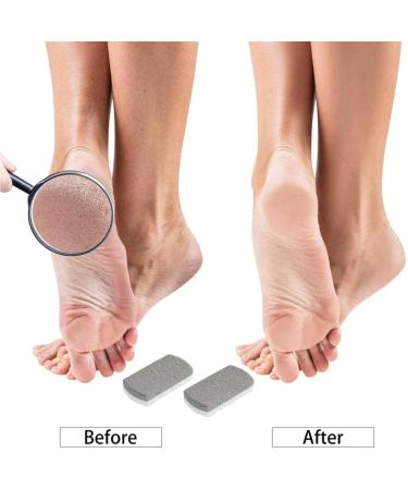 Buy Cuhza Double-Sided Pumice Stones - Effective Foot Care for Hard Skin | 2 Pack Pedicure Stones for Smoothing & Peeling - White Gray - Buy Online on GoSupps.com