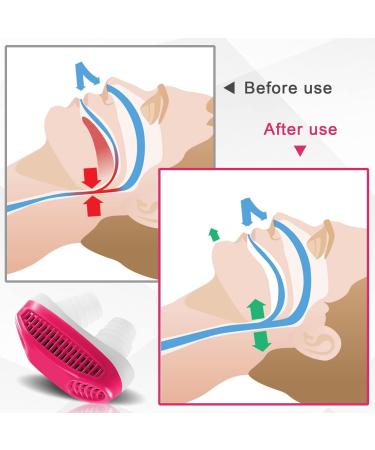 Anti Snoring Nasal Air Purifier - Sleep Apnea Device for Men and Women - Stop Snoring and Improve Sleep Quality - Red - Buy Online on GoSupps.com