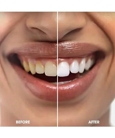 GLO Science GLO Brilliant 3 Pack Teeth Whitening Gel Treatment Kit - Fast, Pain-Free, Long Lasting Results - Cinnamint - Buy Online on GoSupps.com