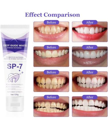 Probiotic Toothpaste for Brightening & Stain Removal | Deep Clean Fresh Breath & Reduce Tooth Stains - Buy Online on GoSupps.com