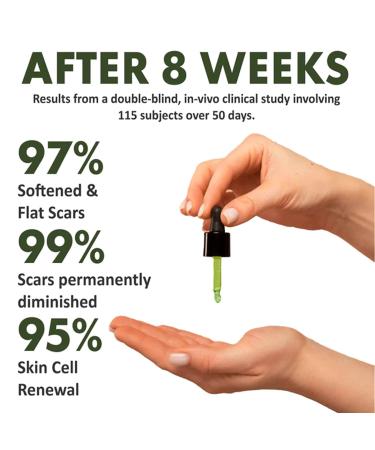 Scar Removal & Skin Repair Serum | Advanced Complex for C-Section, Surgery, Burn, Keloid & Acne | 2 Bottles - Buy Online on GoSupps.com