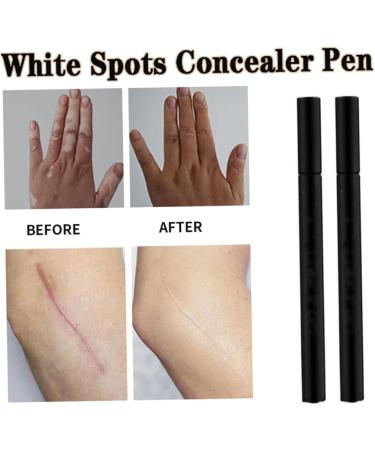 Stylo anti-taches de naissance stylo correcteur de taches blanches imperm able longue dur e cicatrices vitiligo crayon couverture naissance maquillage camouflage naturel - Buy Online on GoSupps.com