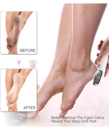 Rechargeable Electric Foot Callus Remover with Smart Light - Fine & Coarse Roller Heads - Pink - Buy Online on GoSupps.com