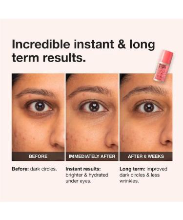 NAPH iNNBEAUTY PROJECT Bright & Tight Dark Circle Firming Eye Cream with Vitamin C & Peptides (0.5 oz / 15 mL) + Bonus Acne Patch (36 Pieces) - Buy Online on GoSupps.com