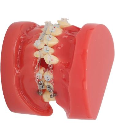 Orthodontic Model 24 Teeth with Metal Wire Case - Ideal for Dental Hospitals | International Shipping Available - Buy Online on GoSupps.com