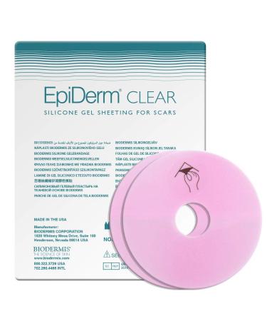 Epi-Derm Areola Circles - 3.0 x .75 in - (1 Pair) (Clear) Silicone Scar Sheets from Biodermis