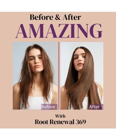 Root Renew 369 Rosemary Oil for Hair Growth - Nigella & Rosemary Essential Oil 60ml | Natural Hair Care Solutions - Buy Online on GoSupps.com