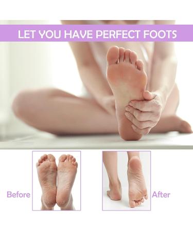 XMOSNZ Pedicure Kit - Professional Stainless Steel Foot Scrubber & Foot Care Tools Set - Buy Online on GoSupps.com