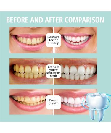 Teeth Total Care Mouthwash - 2025 Best Whitening & Refreshing Foam for All Oral Problems (60 ml 2PCs) - Buy Online on GoSupps.com