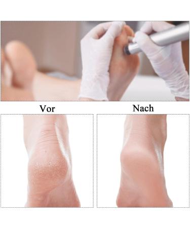 Qingmeng 100PC Foot Grinder Replacement Sandpaper for Cracked Heels | Pedicure Tool Set for Hard Skin Removal - Buy Online on GoSupps.com