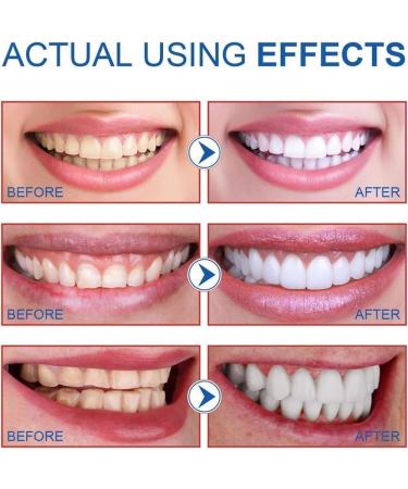 Ultra Whitening Toothpaste SP-6 Probiotic Toothpaste Sp6 Whitening Toothpaste SP 6 Fresh Breath Toothpaste Whitening Toothpaste for Teeth120g - Buy Online on GoSupps.com