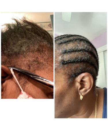 Organic Rosemary Mint Hair Pomade - Strengthening Grease for All Hair Types | Scalp & Hair Treatment (4 OZ) - International Shipping Available - Buy Online on GoSupps.com