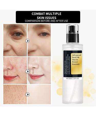 Snail Mucin Essence Snail Repair Face Serum Niacinamide Serum Snail Facial Serum Snail Hydrating Serums Snail Hyaluronic Acid Essence Face Skin Care Snail Essence Improve Dull Skin Essence 100ML - Buy Online on GoSupps.com