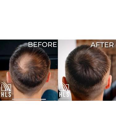 HLS Hair Fibres Black 25g Bottle - Instant Hair Thickening Powder for Women & Men - Buy Online on GoSupps.com