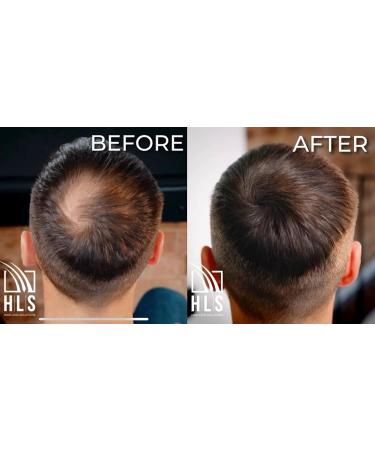 HLS Hair Fibres Auburn | Powder for Thinning 25g Hair fiber Bottle | Instantly Boosts Thickness with Concealer for Women & Men - Buy Online on GoSupps.com